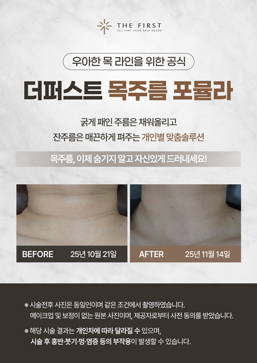 목주름 포뮬라
