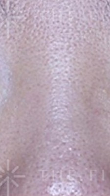 [After]한관종