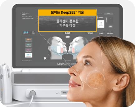 시술주기